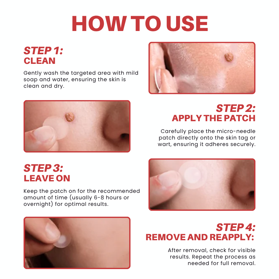 Fivfivgo® MicroNeedle Botanic Skin Tag Removal Patch