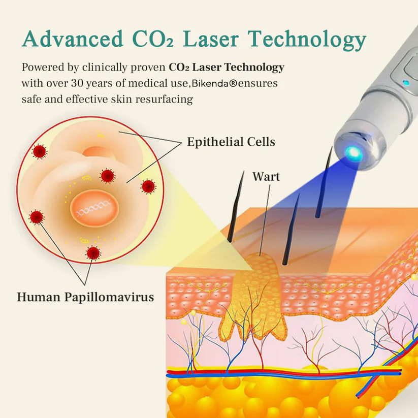 Bikenda® Mole and Wart Instant Removal Laser Pen
