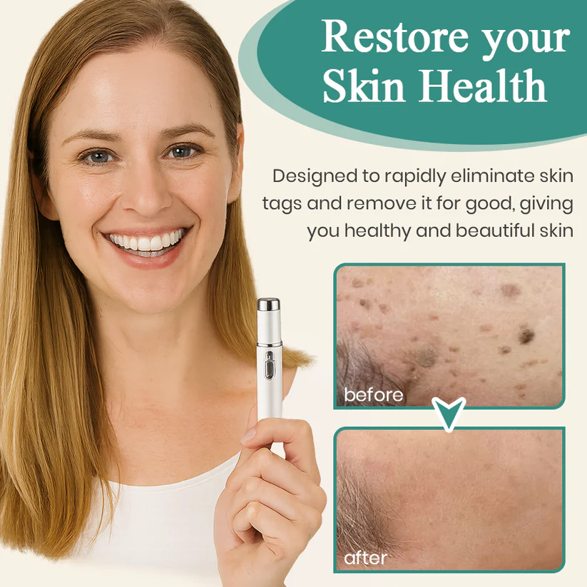 Bikenda® Mole and Wart Instant Removal Laser Pen