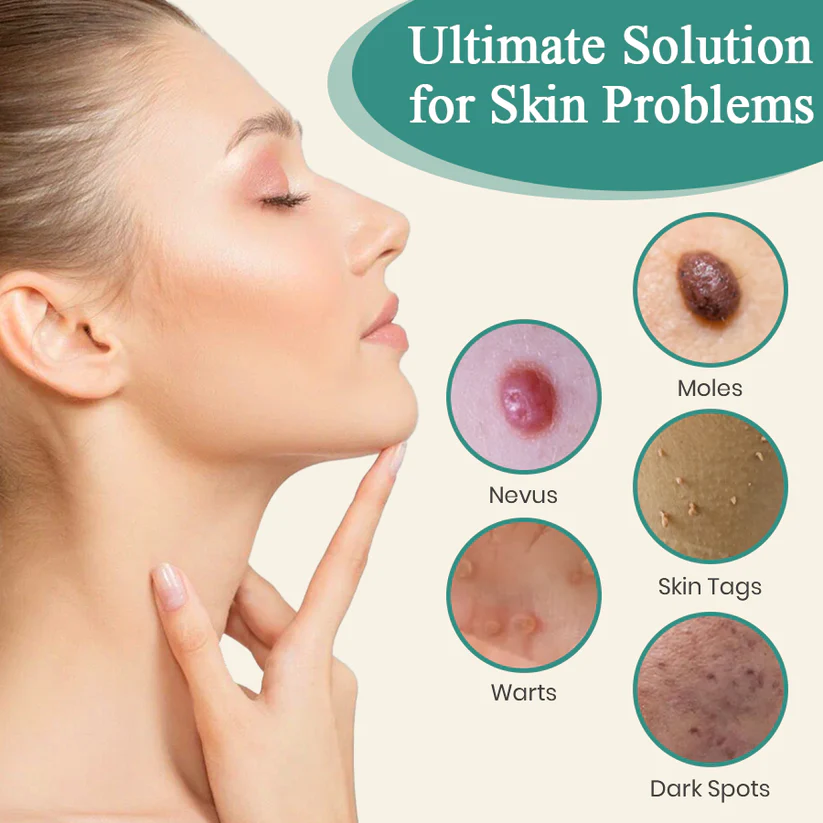 Bikenda® Mole and Wart Instant Removal Laser Pen
