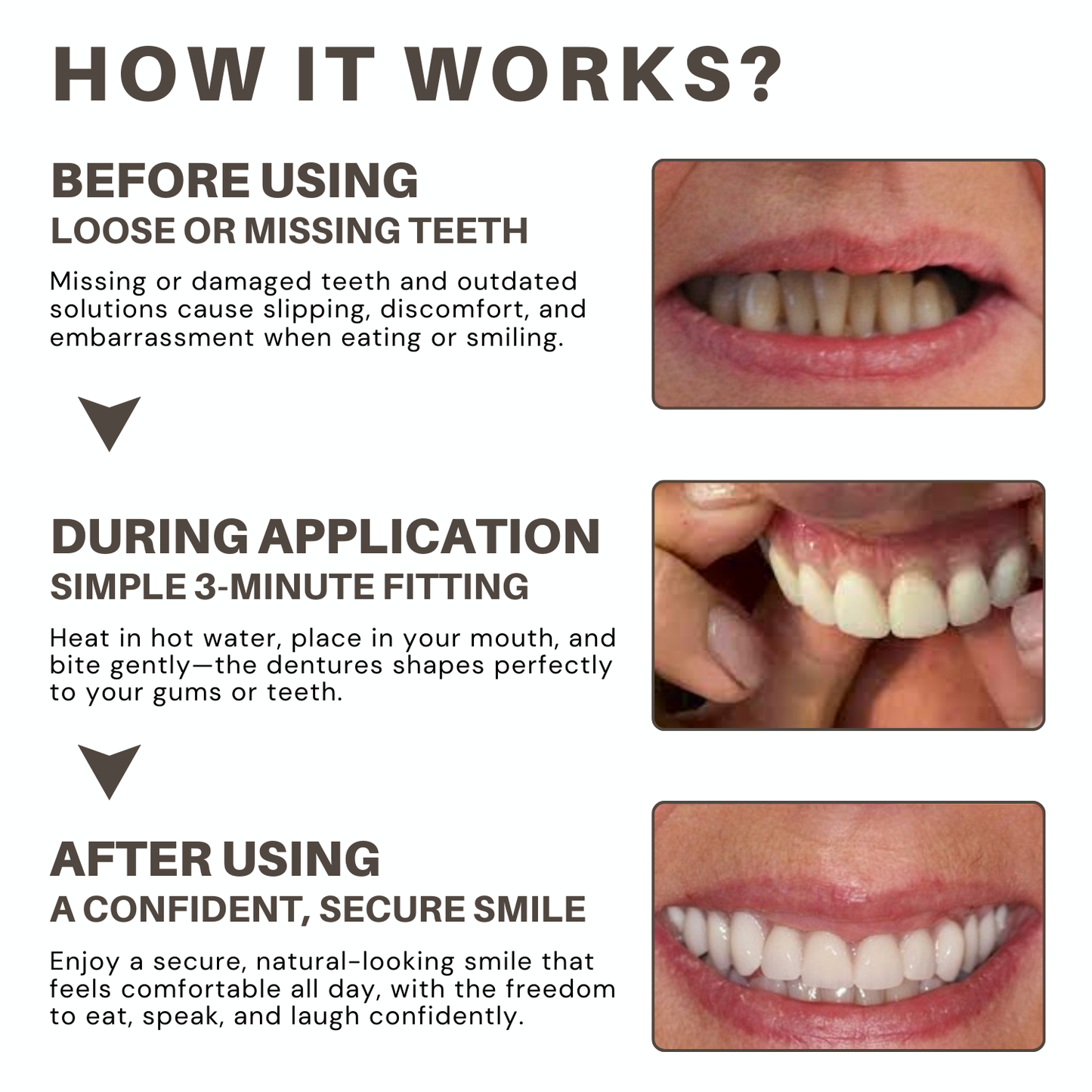 Bikenda® Custom-Fit Full Denture Set