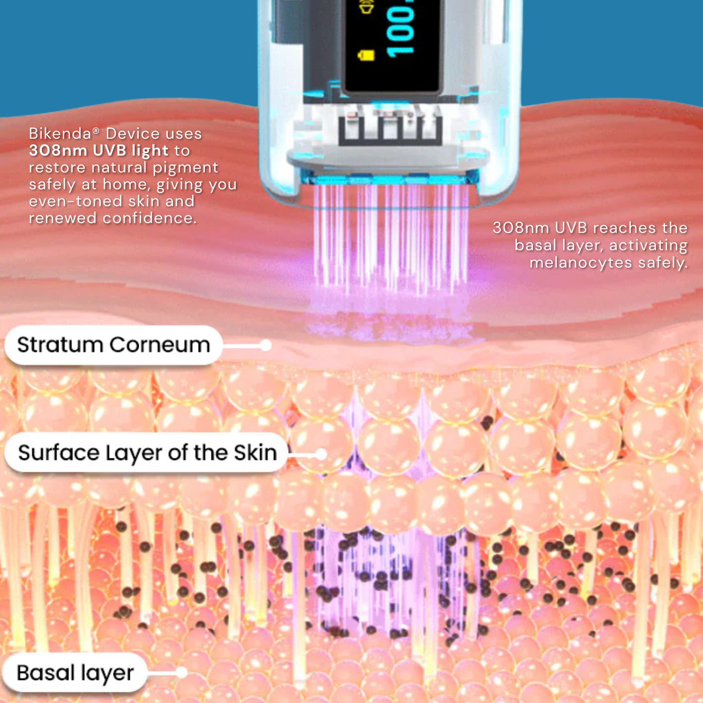 Bikenda® Vitiligo Light Therapy Device