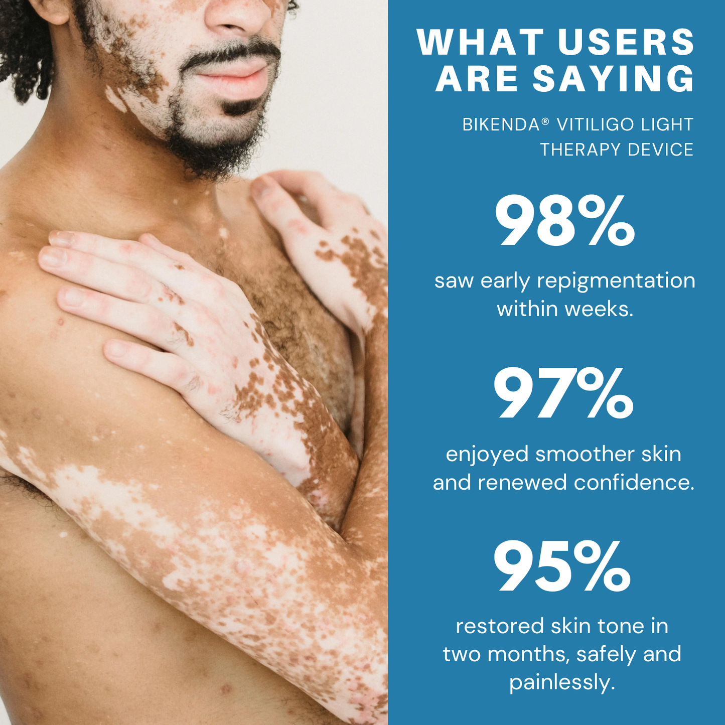 Bikenda® Vitiligo Light Therapy Device
