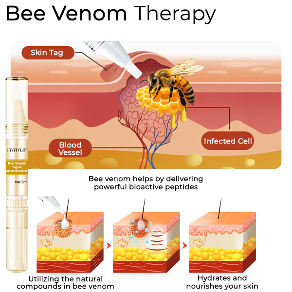 Fivfivgo® Bee Venom Tags & Moles Remover