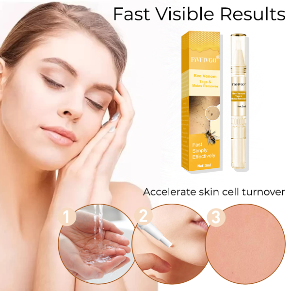 Fivfivgo® Bee Venom Tags & Moles Remover