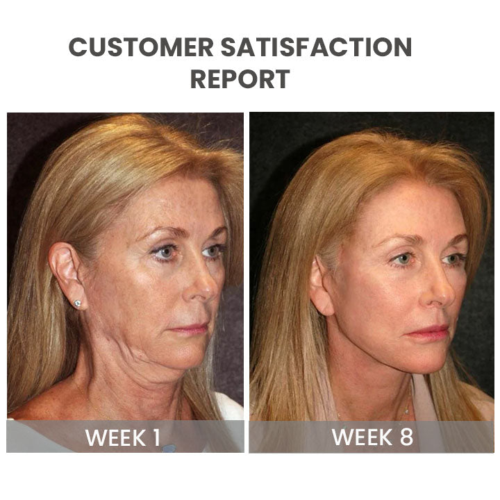 Handy V-Shape Face Massager