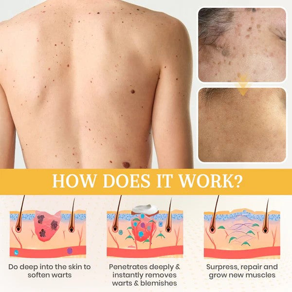 Fivfivgo® DermaErase Advanced Mole & Spot Removal Gel