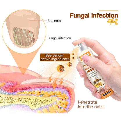 Fivfivgo™ Bee Venom Nail Fungus Spray: Treats various nail problems within 2-4 weeks