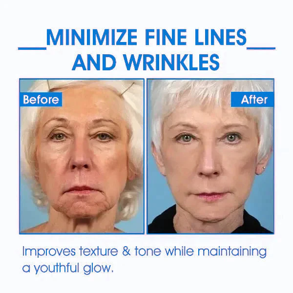 Fivfivgo™ Advanced SkinTightening Rejuvenating Cream