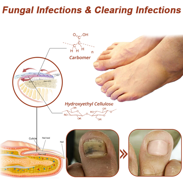 Fivfivgo™ Revolutionary High-Efficiency Light Therapy Device For Toenail Diseases