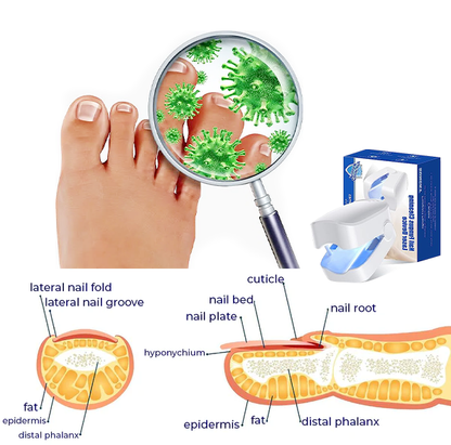 Fivfivgo™ Revolutionary High-Efficiency Light Therapy Device For Toenail Diseases