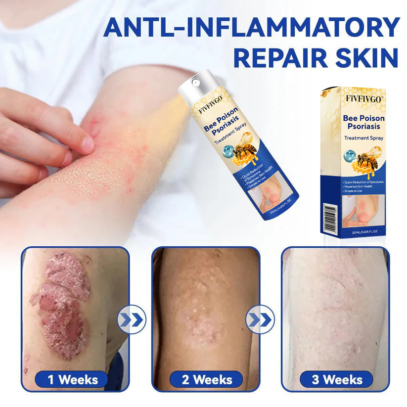 Fivfivgo® Bee Poison Psoriasis Treatment Spray