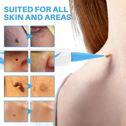 Bikenda® Painless At-home Skin Tag Removal Pen