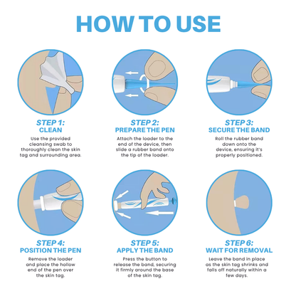 Bikenda® Painless At-home Skin Tag Removal Pen