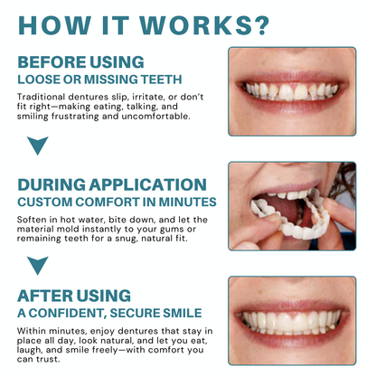 Bikenda® Adjustable Snap-On Dentures