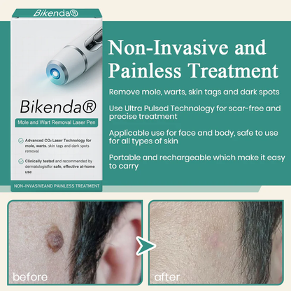 Bikenda® Mole and Wart Instant Removal Laser Pen