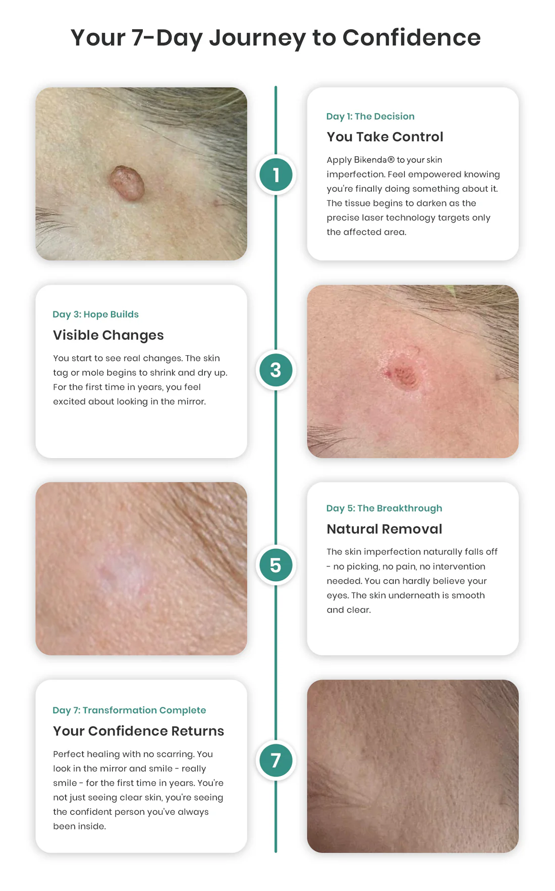 RICPIND® DermaLite Mole and Wart Removal Laser Pen