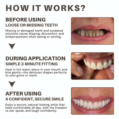 Bikenda® Custom-Fit Full Denture Set