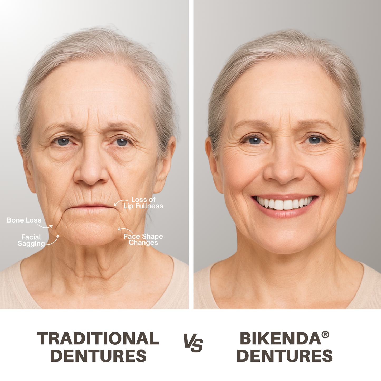 Bikenda® Custom-Fit Full Denture Set