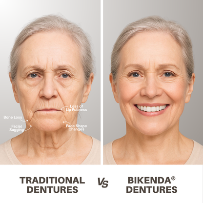 Bikenda® Custom-Fit Full Denture Set