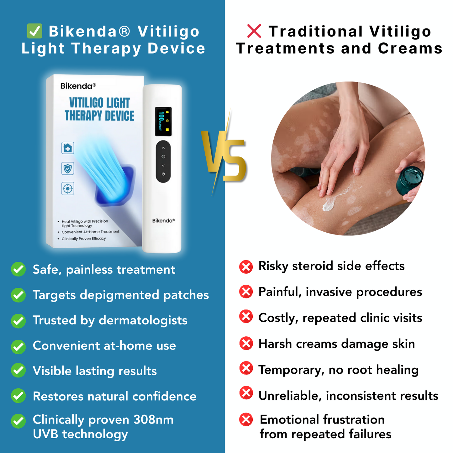 Bikenda® Vitiligo Light Therapy Device