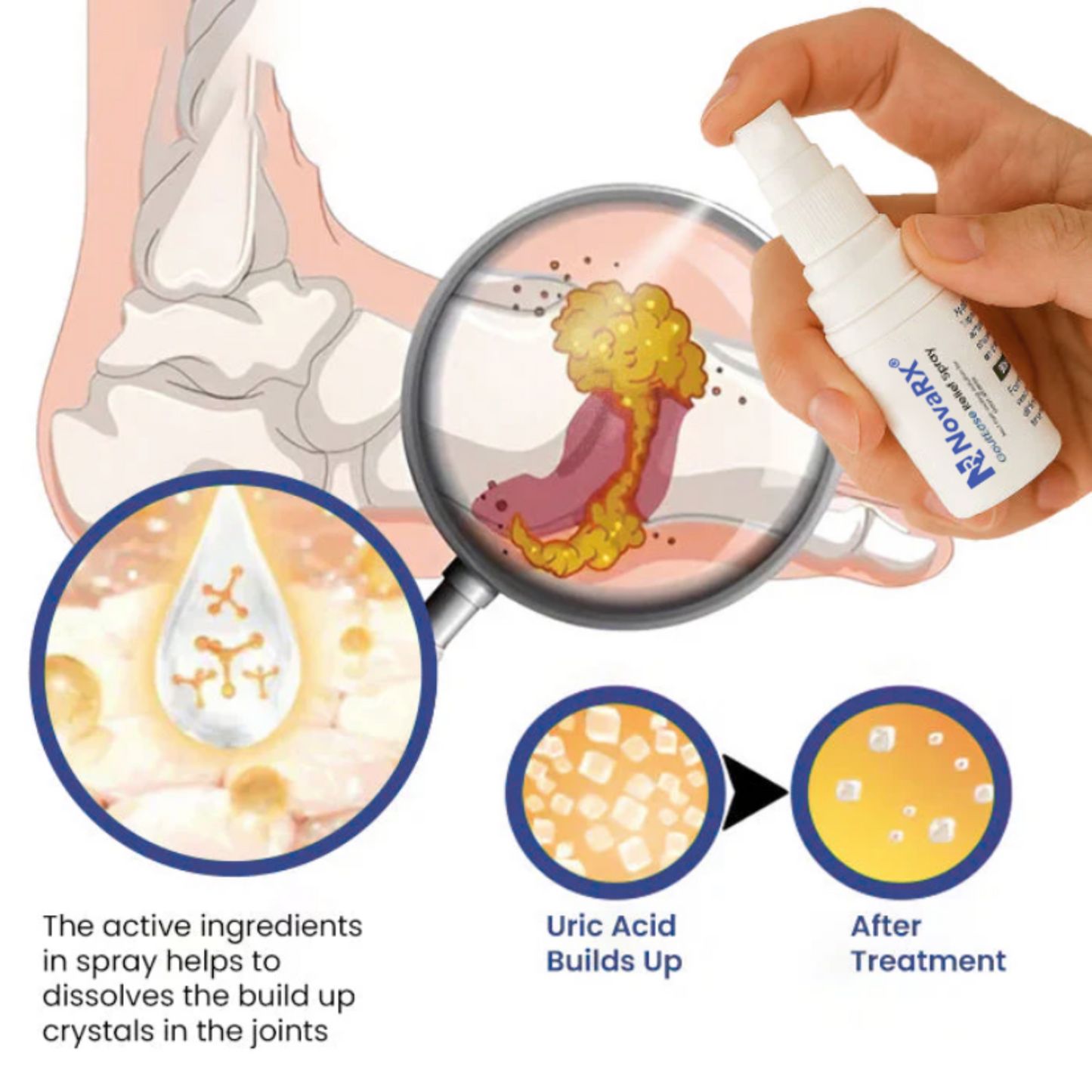 NovaRX® GoutEase Relief Spray