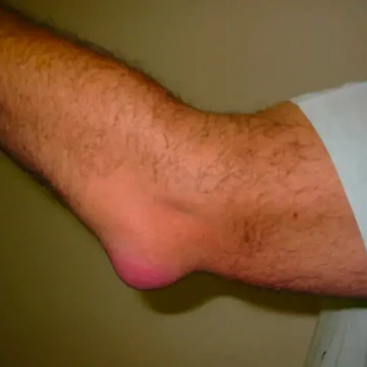 NovaRX® GoutEase Relief Spray image NovaRX® GoutEase Relief Spray