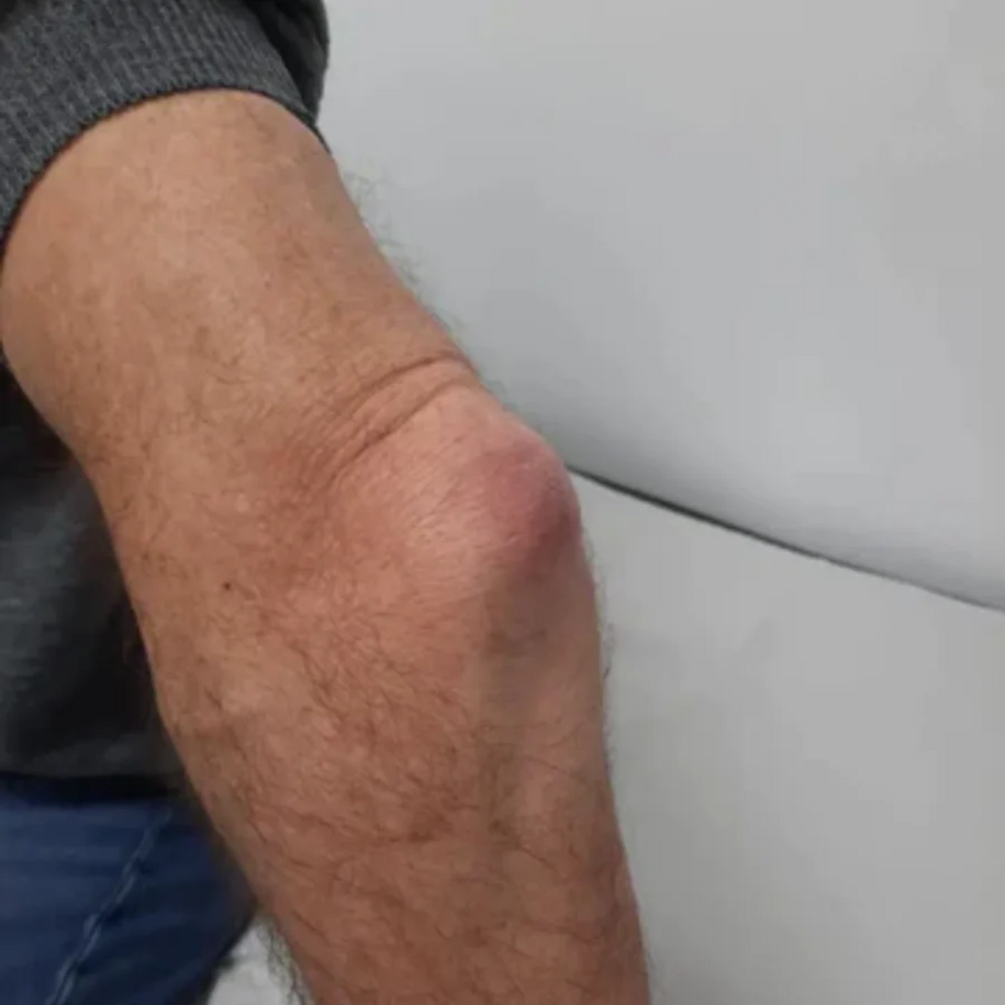 NovaRX® GoutEase Relief Spray image NovaRX® GoutEase Relief Spray