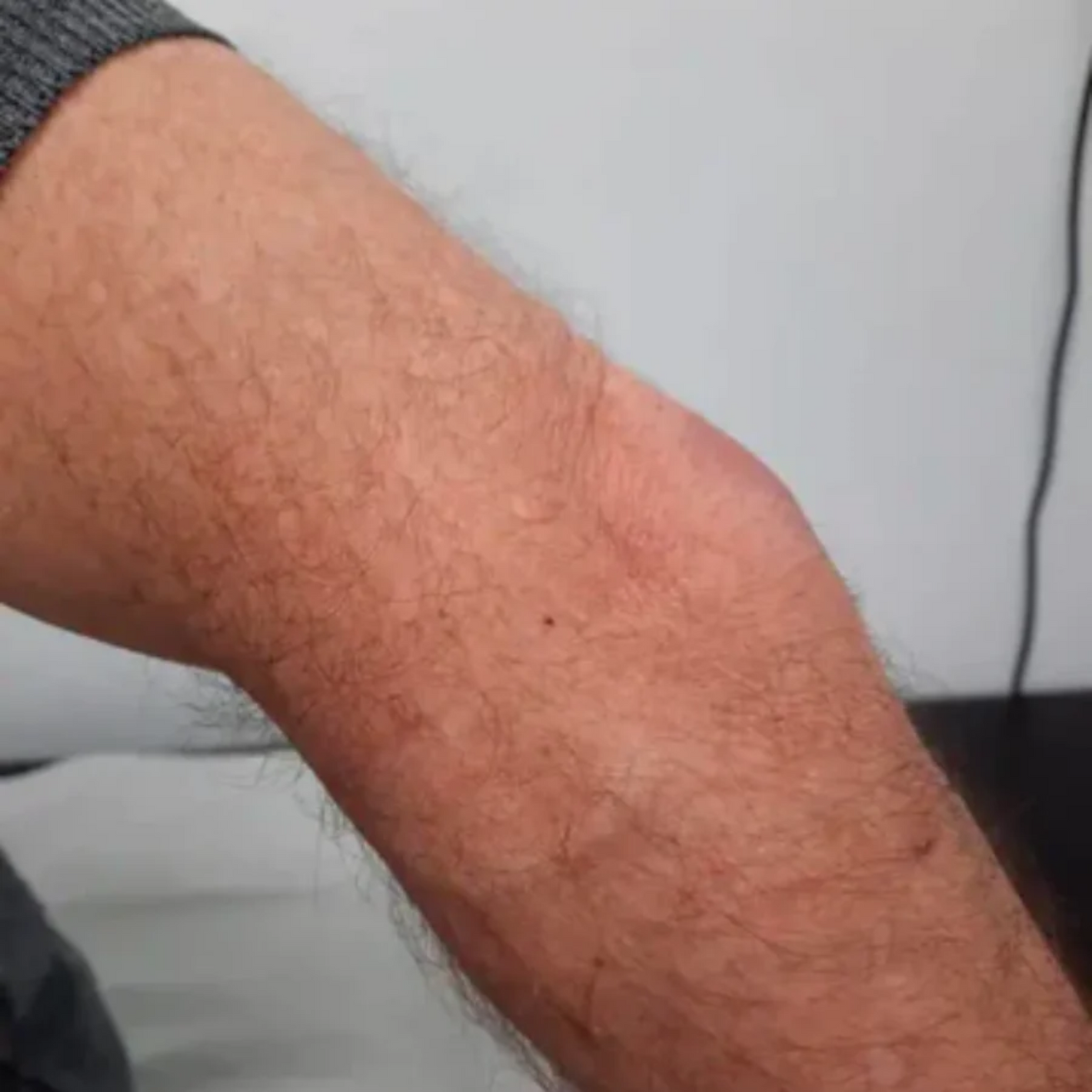 NovaRX® GoutEase Relief Spray image NovaRX® GoutEase Relief Spray