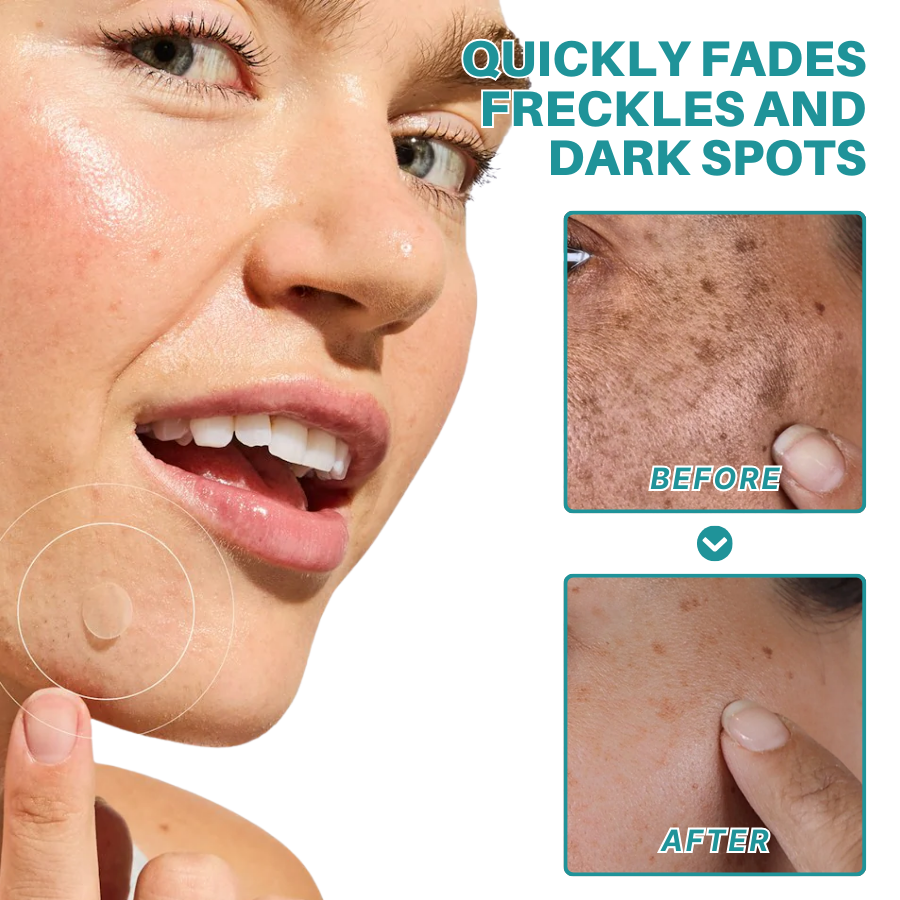 Fivfivgo® Botanical Freckles & Spot Removal Patch 16 Fivfivgo® Botanical Freckles & Spot Removal Patch