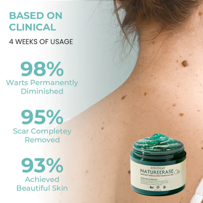 ✅ Official Store: Fivfivgo® NatureErase Instant Mole & Spot Removal Gel PRO