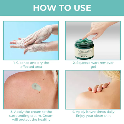 ✅ Official Store: Fivfivgo® NatureErase Instant Mole & Spot Removal Gel PRO
