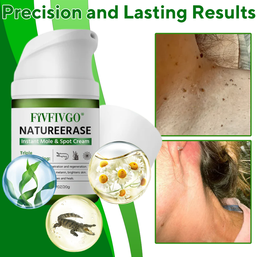 Fivfivgo® NatureErase Instant Mole & Spot Cream