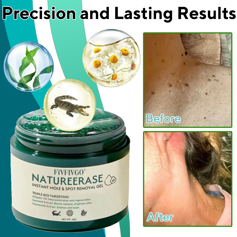 Fivfivgo® NatureErase Instant Mole & Spot Removal Gel PRO image Fivfivgo® NatureErase Instant Mole & Spot Removal Gel PRO