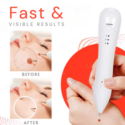 Bikenda® Portable Skin Care Laser Pen PRO