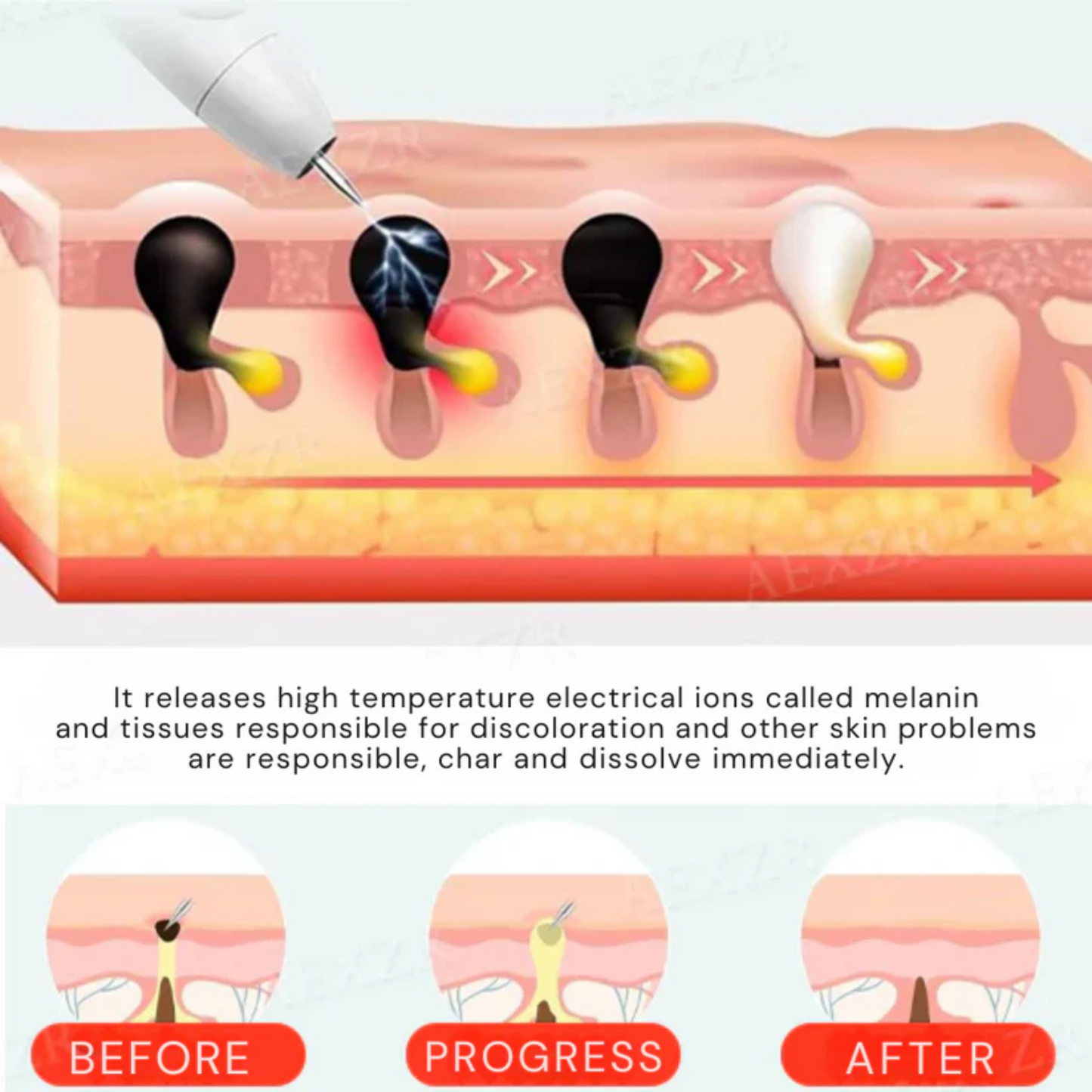 Bikenda® Portable Skin Care Laser Pen PRO