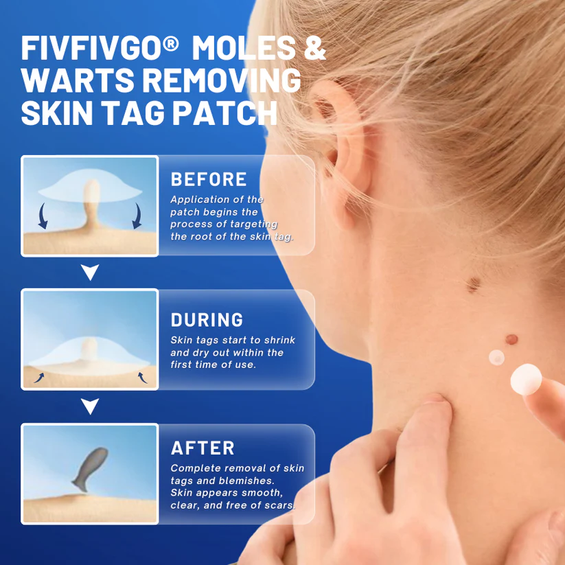 Fivfivgo® Moles & Warts Removing Skin Tag Patch