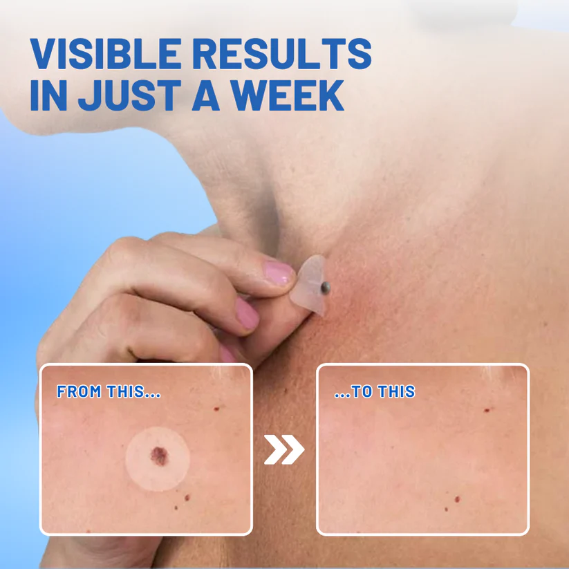 Fivfivgo® Moles & Warts Removing Skin Tag Patch image Fivfivgo® Moles & Warts Removing Skin Tag Patch