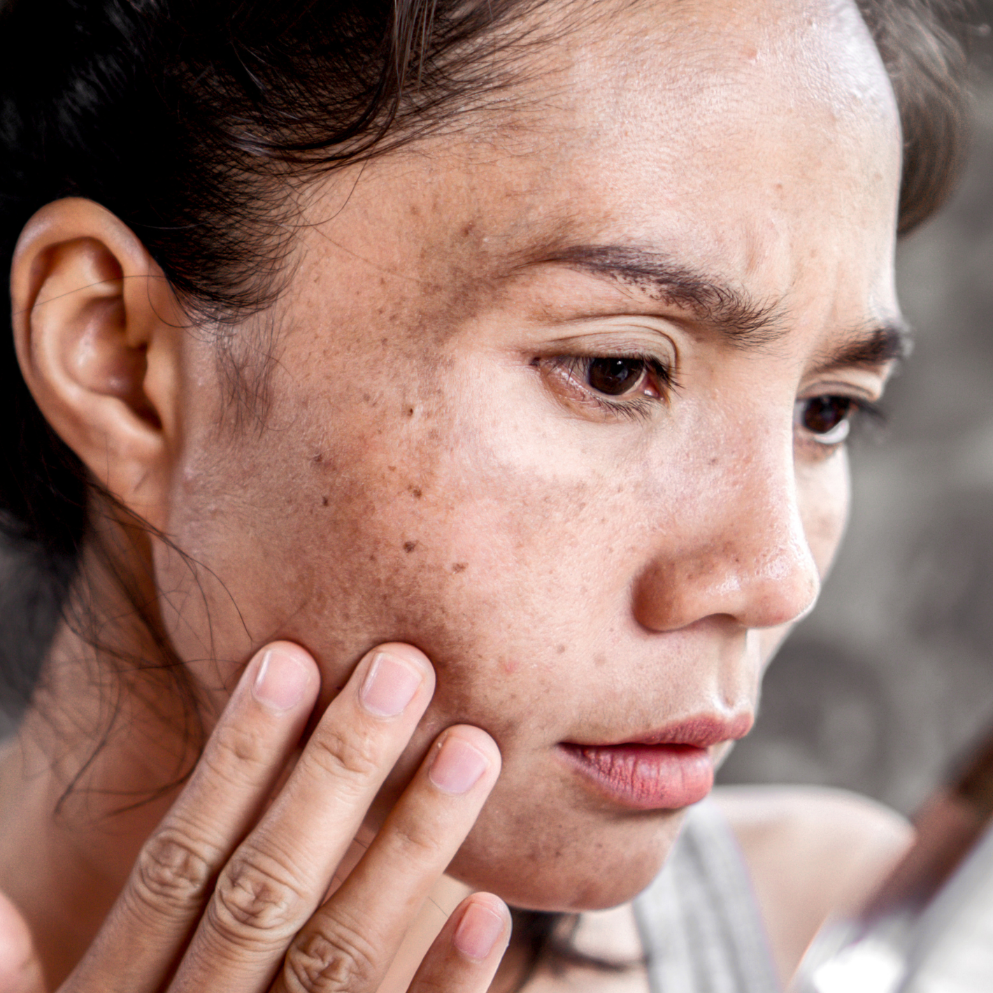 Fivfivgo® Herbal Spots Peel-Off Facial Mask image Fivfivgo® Herbal Spots Peel-Off Facial Mask