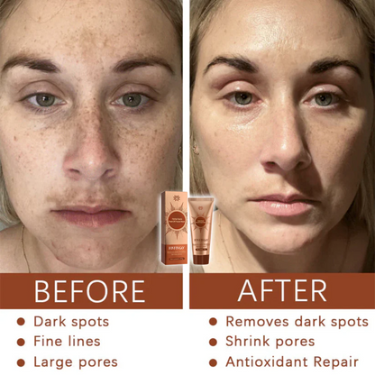 Fivfivgo® Herbal Spots Peel-Off Facial Mask