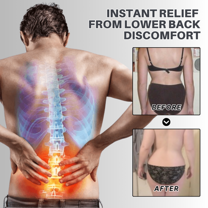 NovaRX® Sciatic Relieving Cream