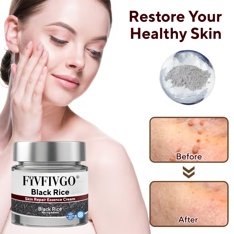 Fivfivgo® Black Rice Skin Repair Essence Cream