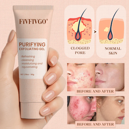 Fivfivgo® Purifying Exfoliating Gel for Acanthosis Nigricans, Exfoliation, Dark Spots, Skin Tags, and Eczema