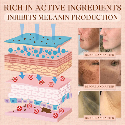 Fivfivgo® Purifying Exfoliating Gel for Acanthosis Nigricans, Exfoliation, Dark Spots, Skin Tags, and Eczema