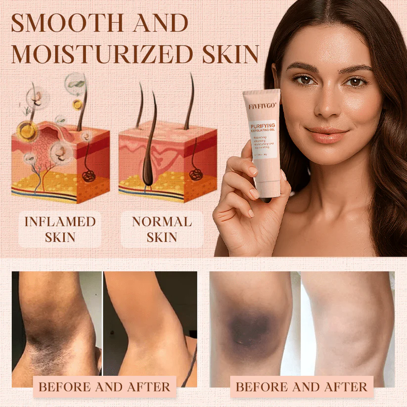 Fivfivgo® Purifying Exfoliating Gel for Acanthosis Nigricans, Exfoliation, Dark Spots, Skin Tags, and Eczema