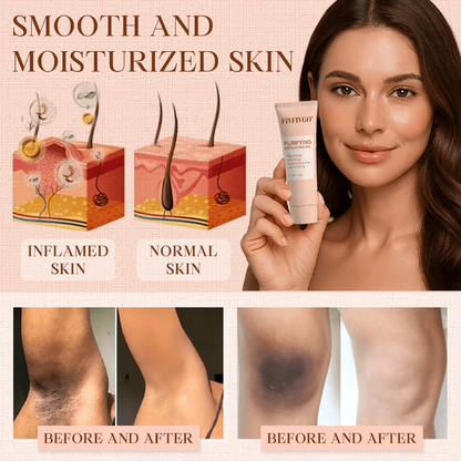 Fivfivgo® Purifying Exfoliating Gel for Acanthosis Nigricans, Exfoliation, Dark Spots, Skin Tags, and Eczema