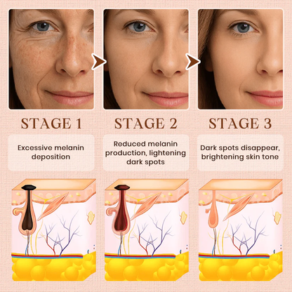 Fivfivgo® Purifying Exfoliating Gel for Acanthosis Nigricans, Exfoliation, Dark Spots, Skin Tags, and Eczema