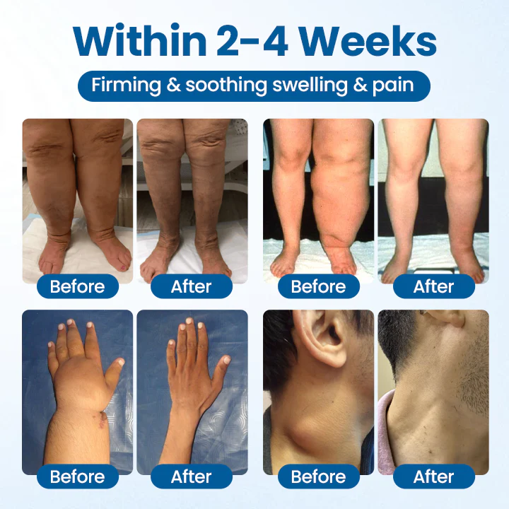 NovaRX® Lymphora Swelling Relief Roll-On