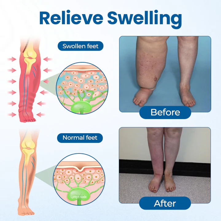NovaRX® Lymphora Swelling Relief Roll-On