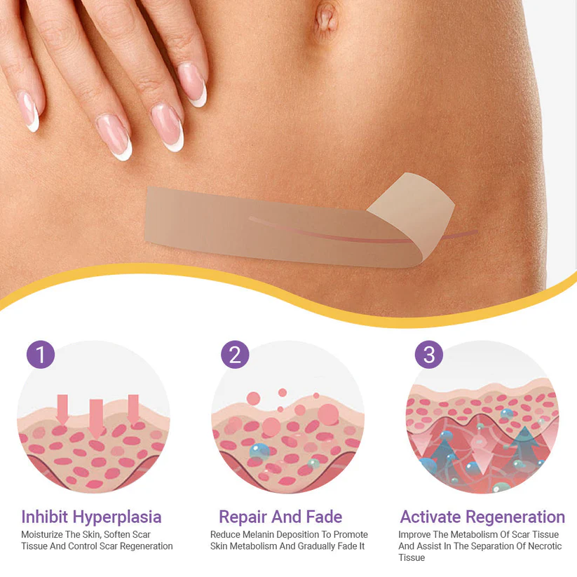 Fivfivgo® Hyaluronic Acid Nano Microneedle Repair Tape (Treatment of old and new scars, reduction of surgical scars, stretch marks, keloids, acne, burns, warts, dermatomes and varicose veins)